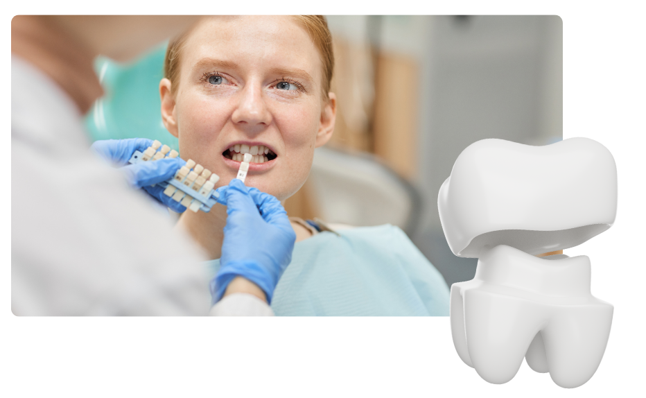 Dental Crowns