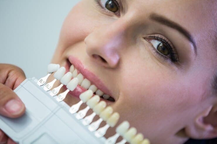 veneers brookline